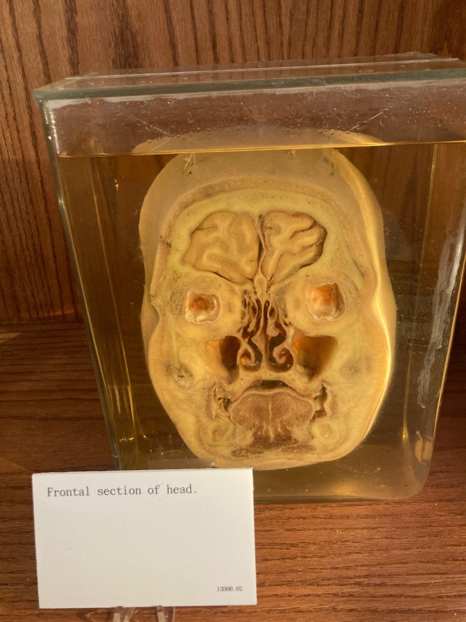 Frontal section of head on display.